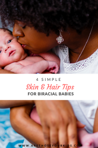 If you are a parent to a biracial child, finding the right hair and skin products can be a challenge. Biracial babies often need products that provide their hair and skin with more moisture.
